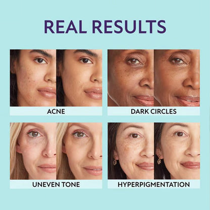🎉Allt-i-ett-fuktkräm, concealer och täckning 💧✨ Lätt och vattenfast